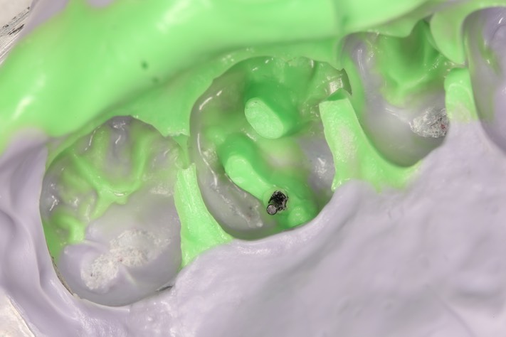 8Kyle Chock #14 impression