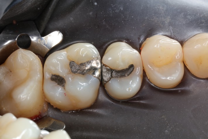 Alan Chinn #13 pre-op