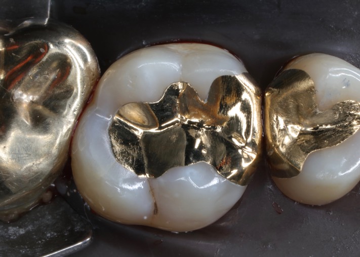 Alan Chinn #14 finish