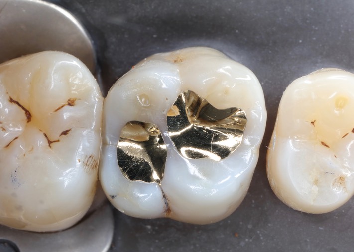 Alan Chinn #14 finish