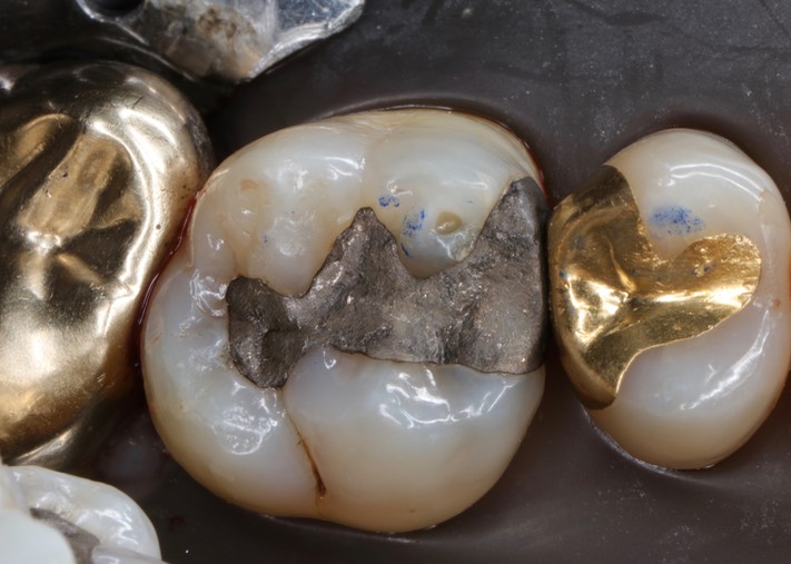 Alan Chinn #14 pre-op