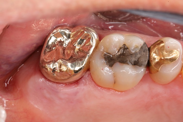 Alan Chinn #15 finish