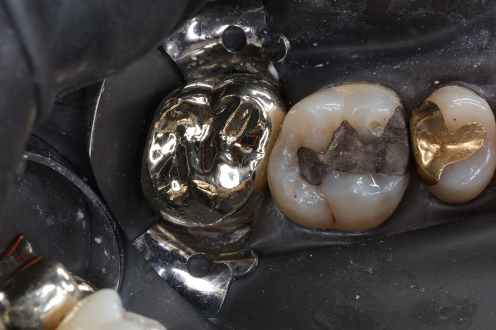 Alan Chinn #15 finish