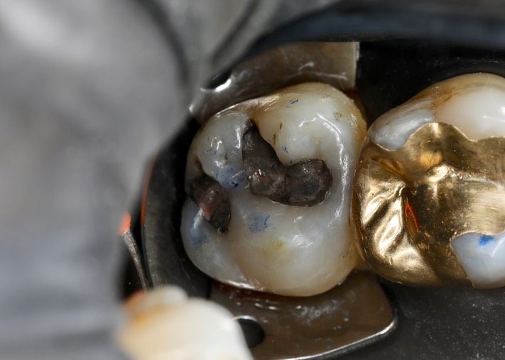 Alan Chinn #15 pre-op