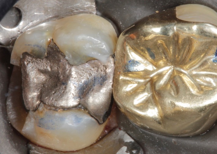 Alan Chinn #15 pre-op