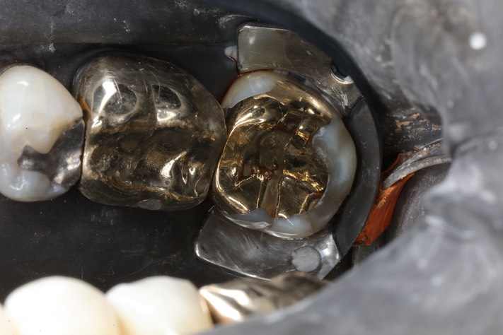 Alan Chinn #18 finish