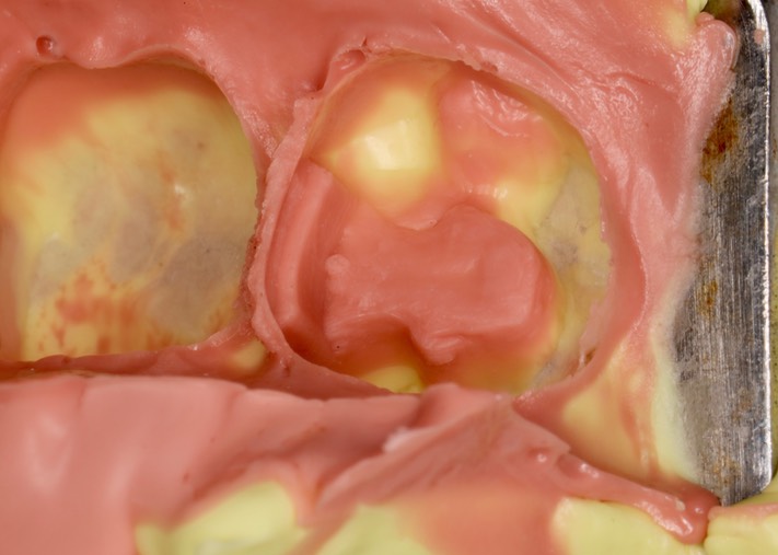 Alan Chinn #18 impression