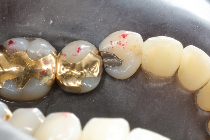 Alan Chinn #28 pre-op