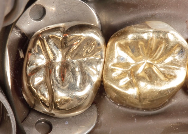 Alan Chinn #3 finish