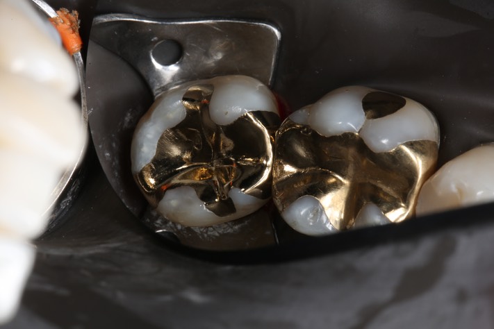 Alan Chinn #31 finish