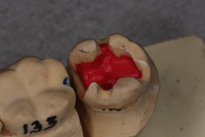 Alan Chinn #31 model