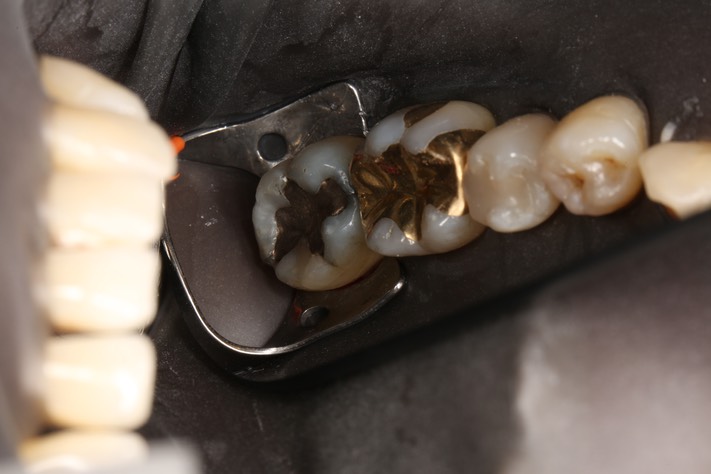 Alan Chinn #31 pre-op