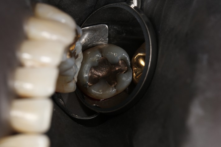 Alan Chinn #31 pre-op