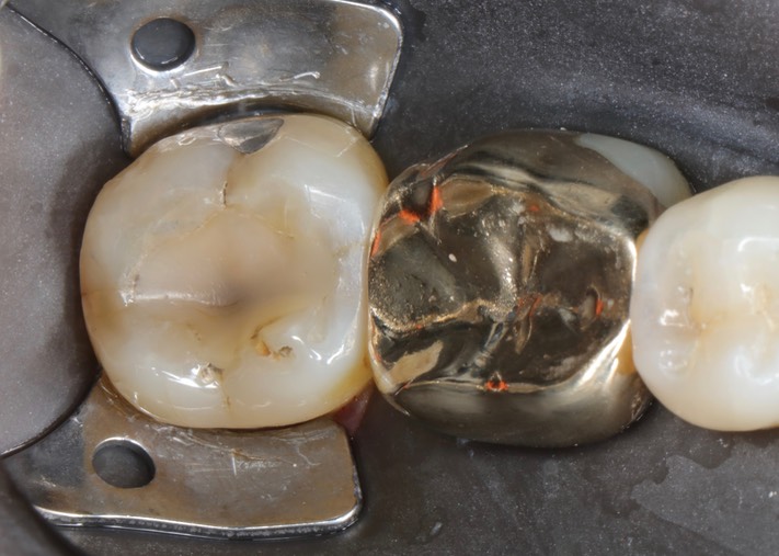 Alan Chinn #31 pre-op