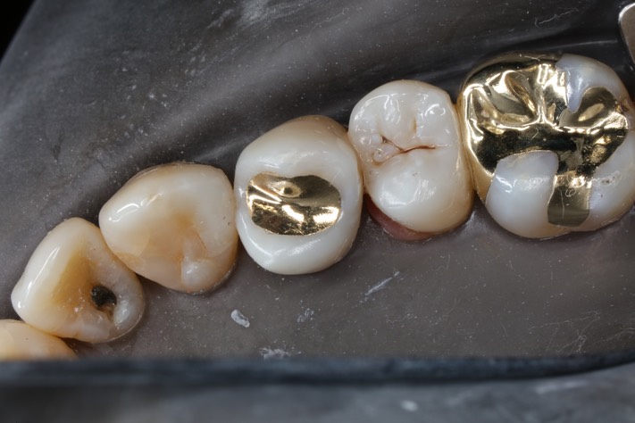 Alan Chinn #5 finish