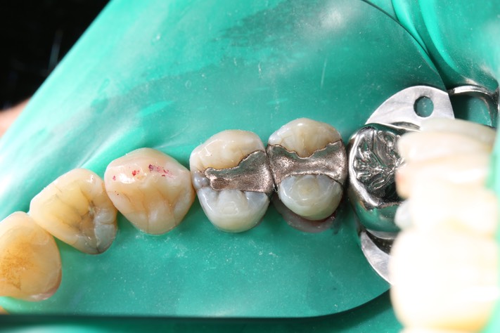 Alan Tamashiro #4 pre-op