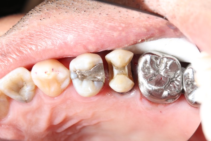 Alan Tamashiro #4 prep