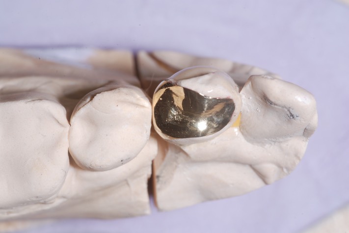 Brandon Yokota #21 casting