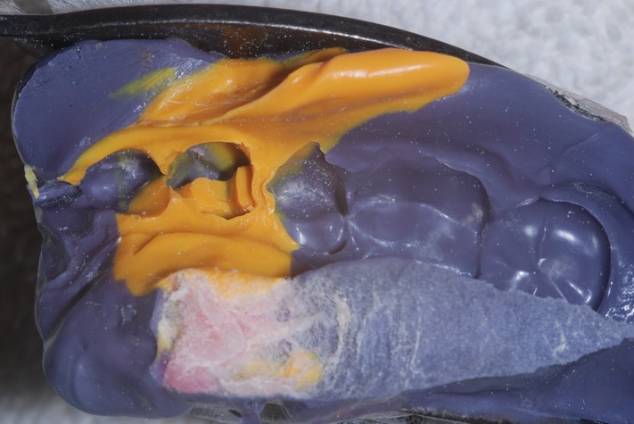 Brandon Yokota #21 impression