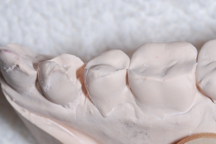 Brandon Yokota #21 model