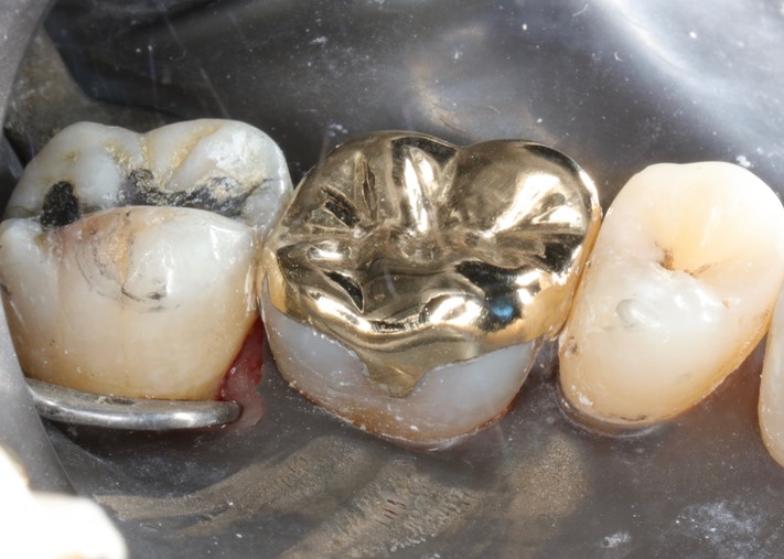 Brian Sato #14 finish lingual