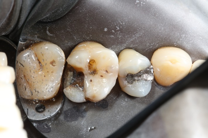 Brian Sato #14 pre-op