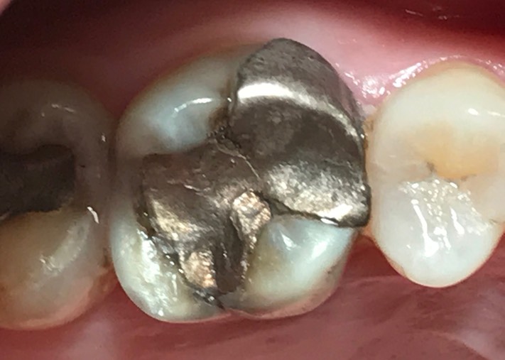 Brian Sato #14 pre-op