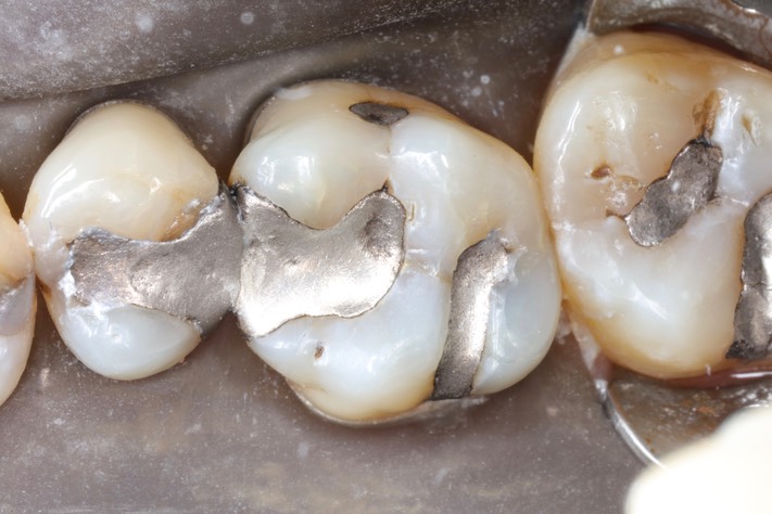 Brian Sato #3 pre-op