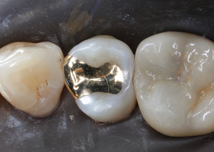 Brian Sato #5 finish