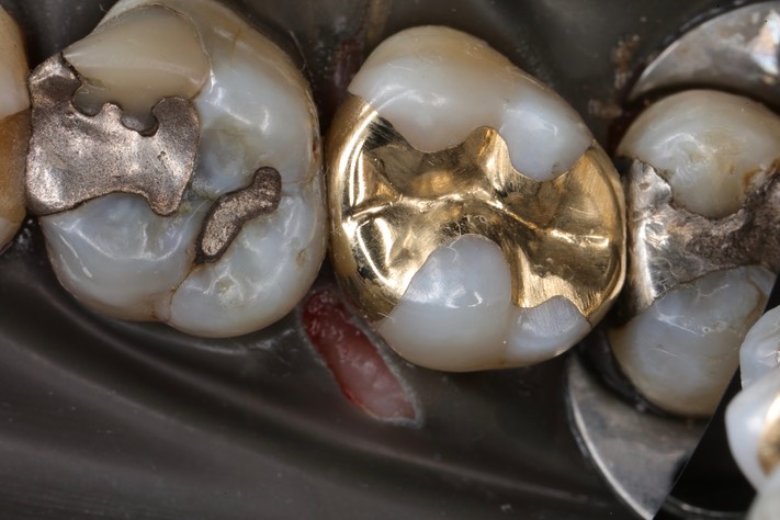 Bryan Sato #2 finish