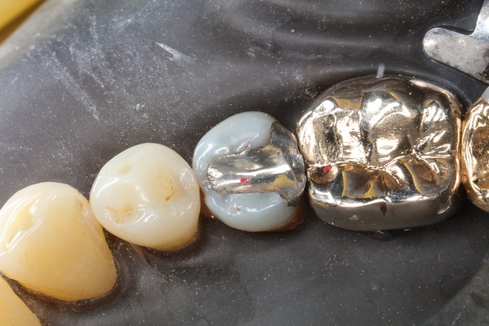 Bryan Sato #20 pre-op