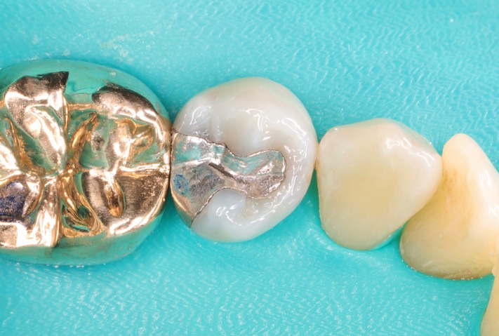 Bryan Sato #29 pre-op