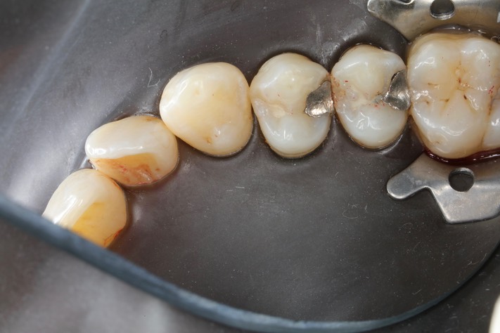 Bryan Sato #5 pre-op