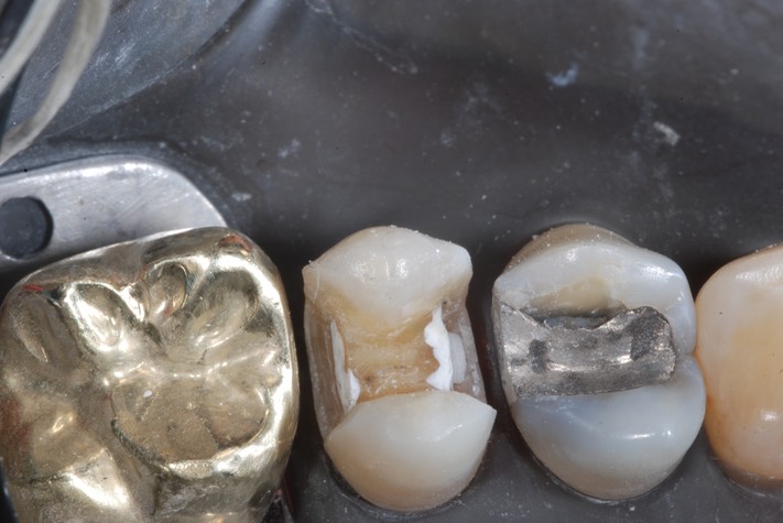 Carla Fukumoto #13 prep