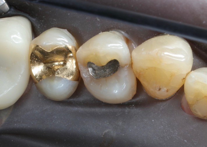 Chris Woo #12 pre-op