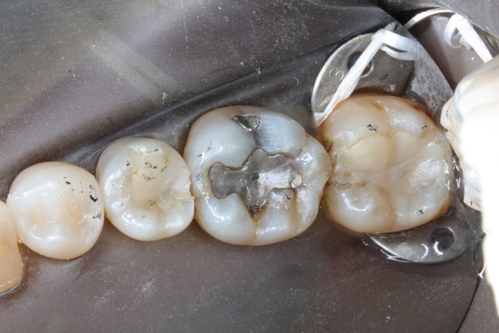 Chris Woo #19 pre-op