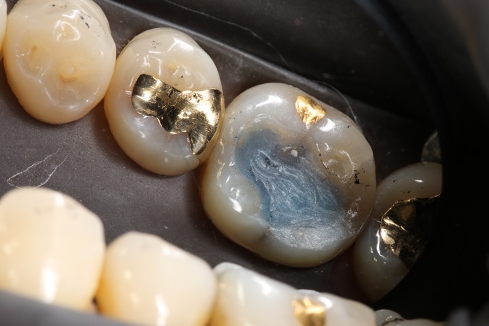 Chris Woo #19 pre-op