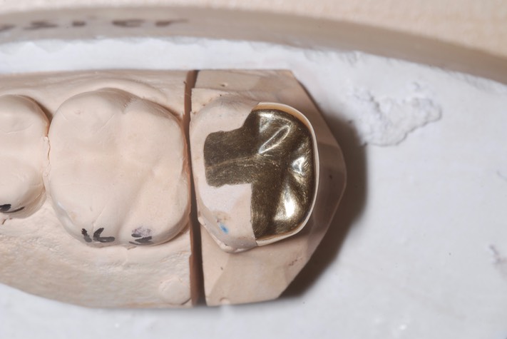 Chris Woo #2 half crown