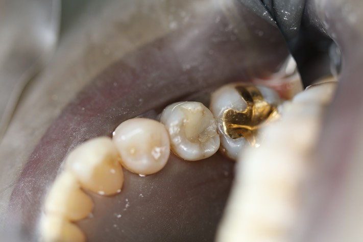 Chris Woo #20 pre-op