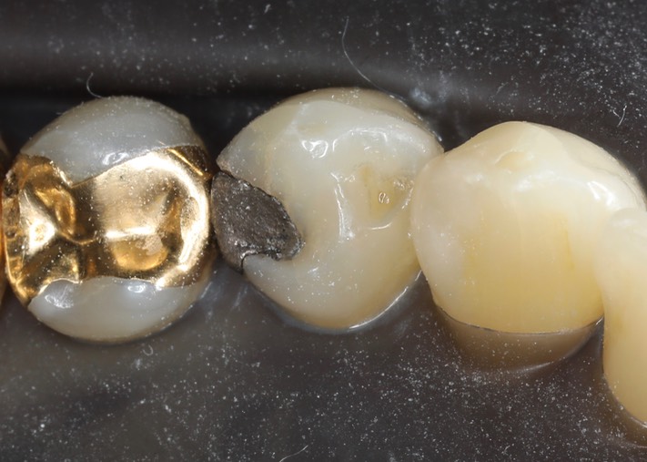 Chris Woo #28 pre-op