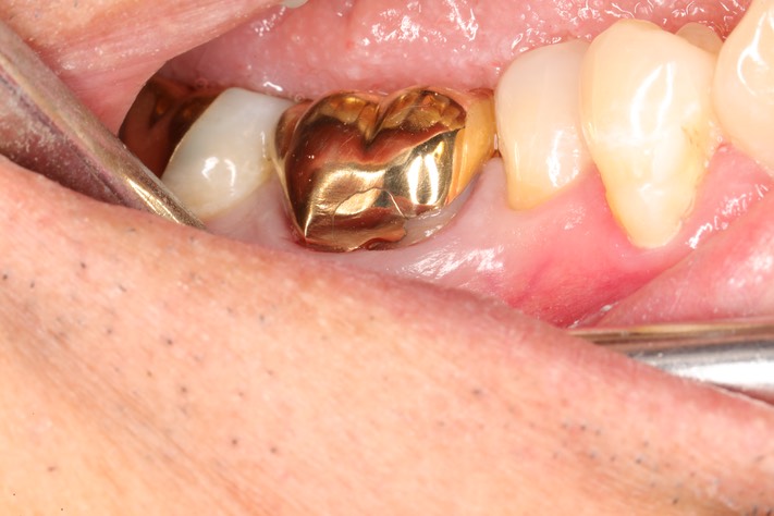 Chris Woo #30 finish