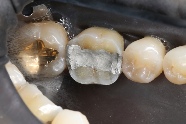 Chris Woo #30 pre-op