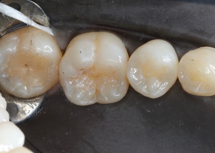 Chris Woo #30 pre-op