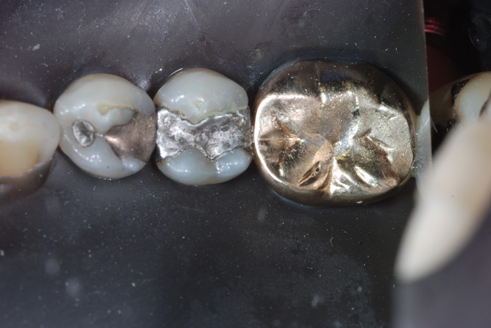 Matt Dodson #20 pre-op