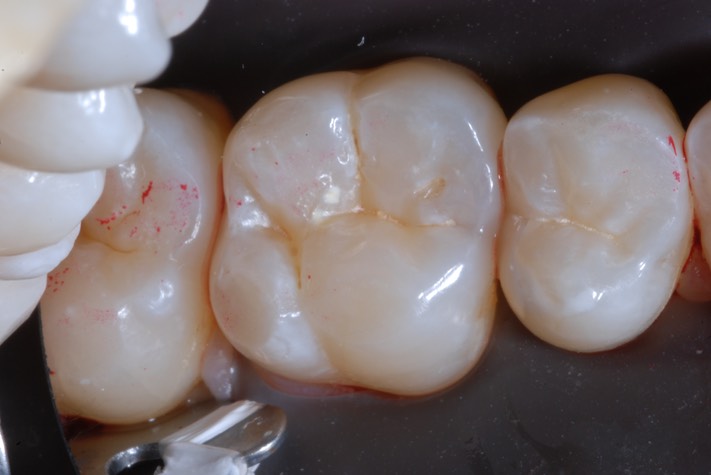 Roland Ylarde #3 pre-op