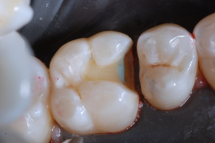 Roland Ylarde #3 prep