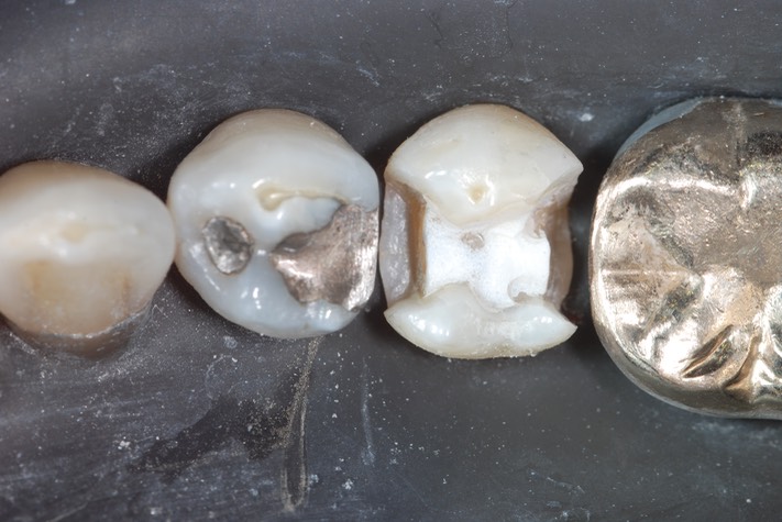 Matt Dodson #20 prep