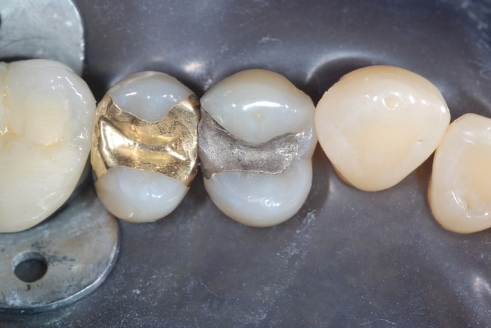 Wayne Chin #12 pre-op