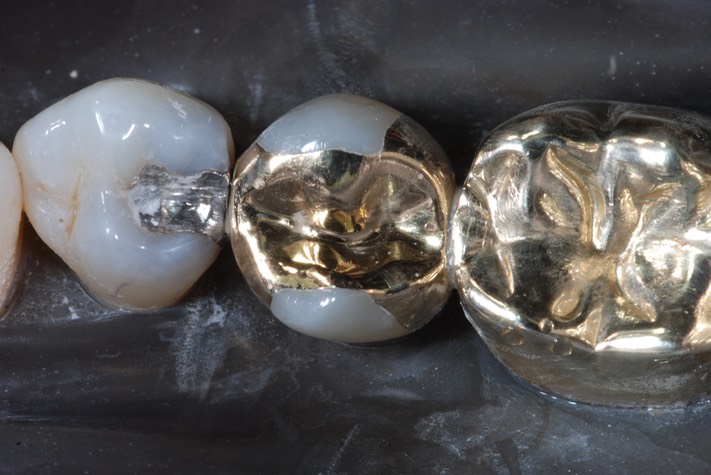 Wayne Chin #20 finish