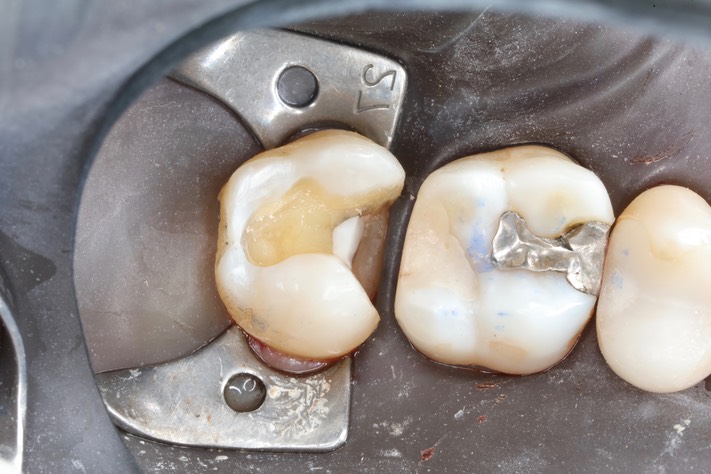 Frank Fukuda #15 prep